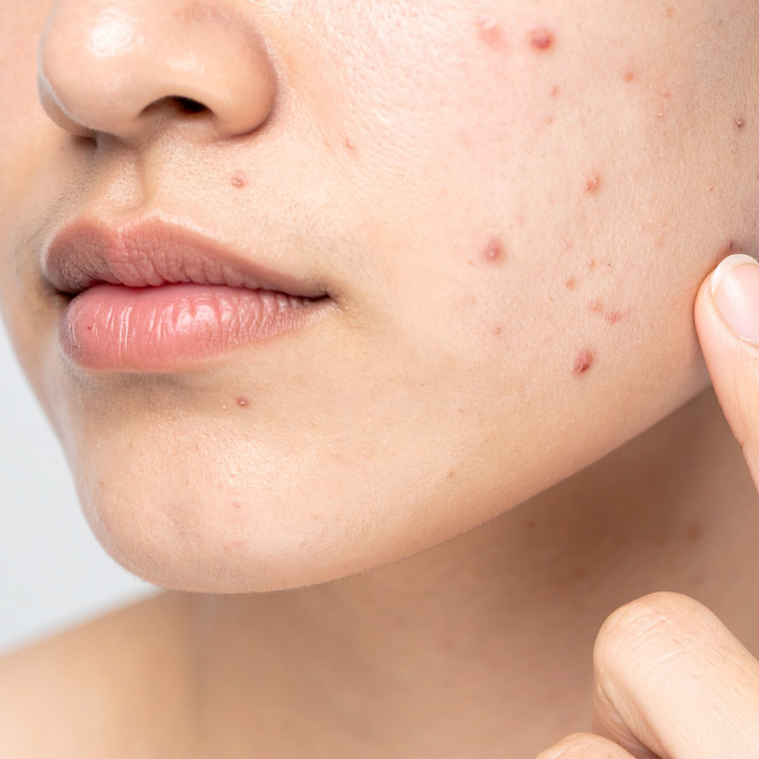 Balsam cu 25% Teufelskralle